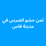 ثمن حشو الضرس في فاس