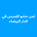 ثمن حشو الضرس في الدار البيضاء