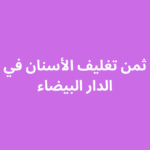 ثمن تغليف الأسنان في الدار البيضاء