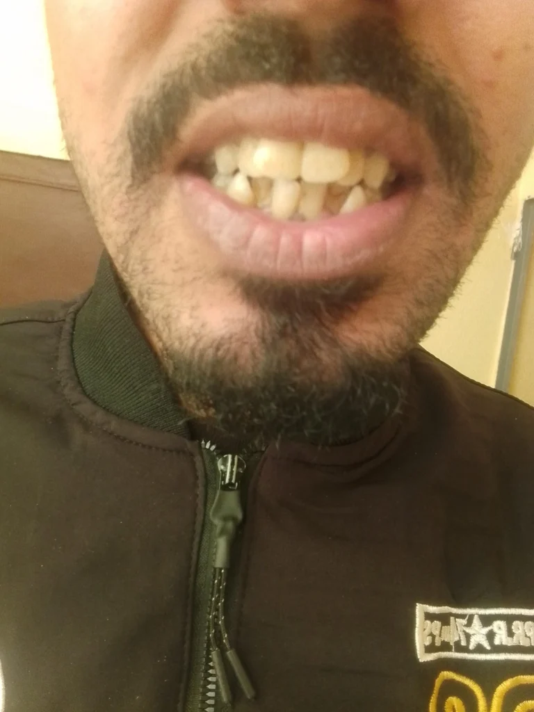 تديل الاسنان