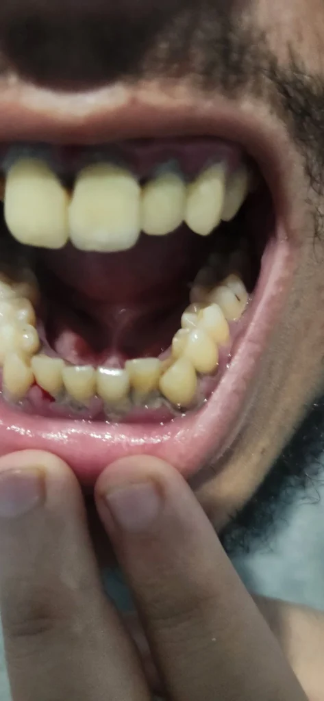 صورة السؤال