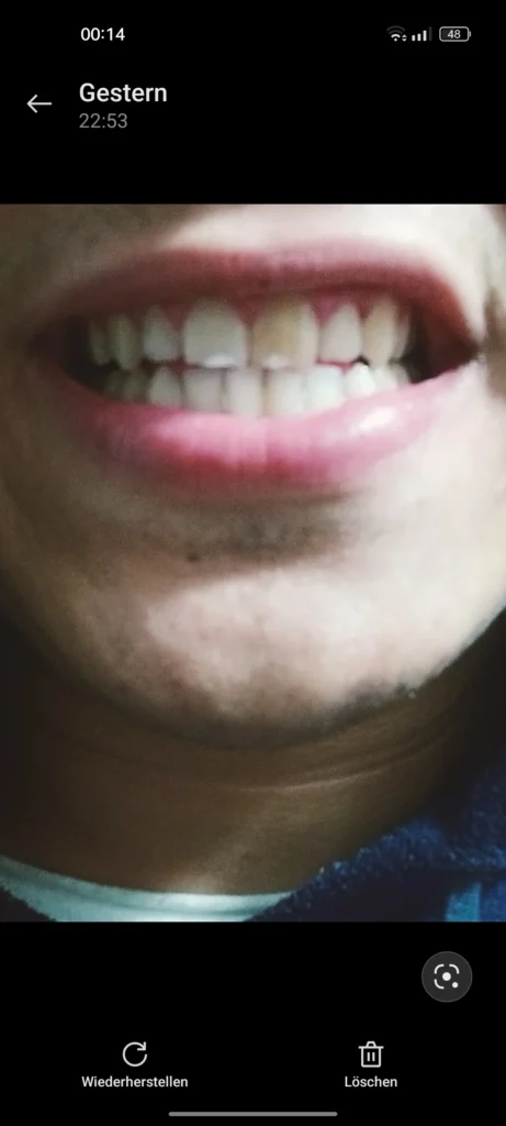 تجميل الأسنان