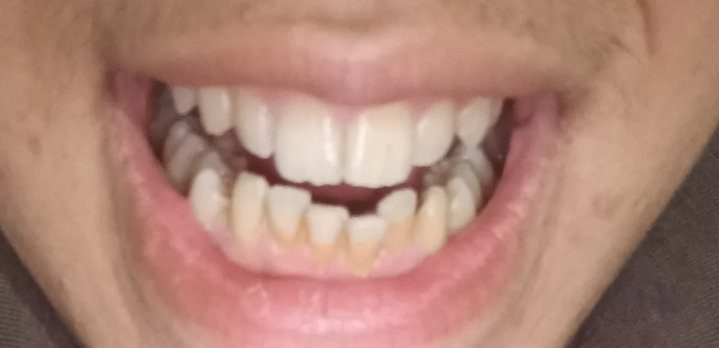 تقويم الاسنان