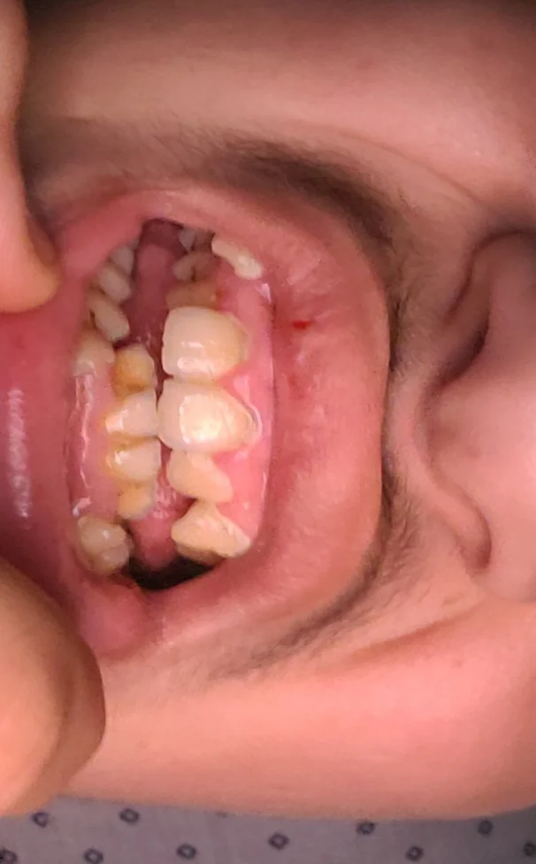 فكرة عن المشكل الظي يحتاج للتقويم