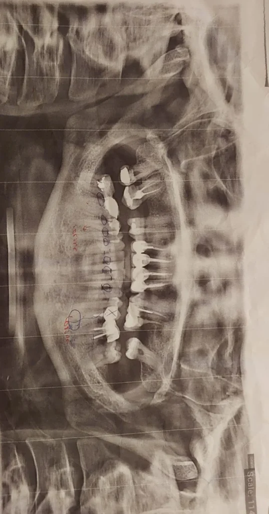 صورة السؤال