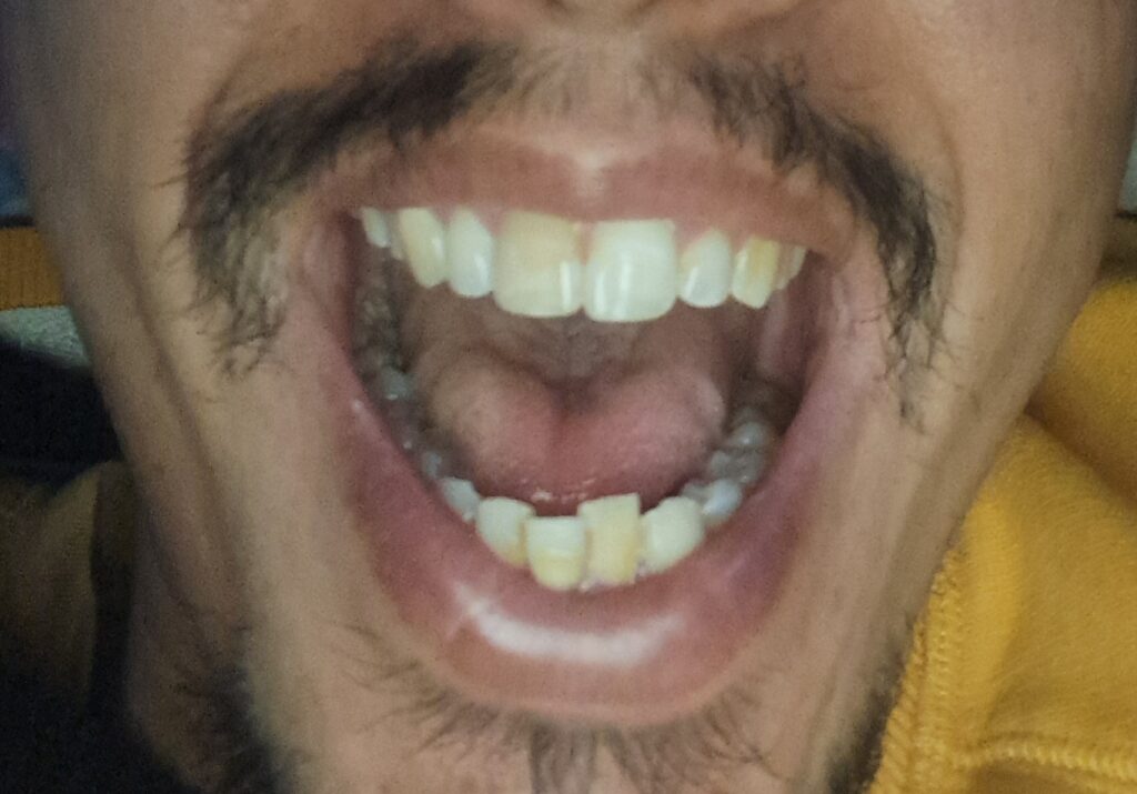Mourad – Casablanca – Orthodontie
