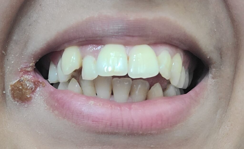 حفصة صوف – Casablanca – Orthodontie