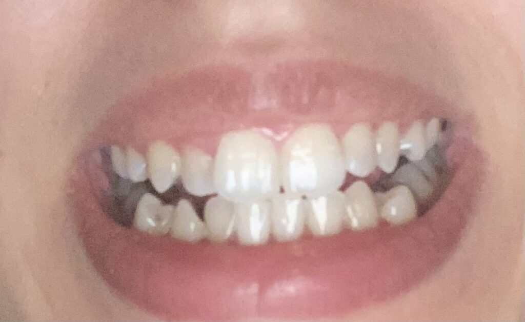 Imane As – Casablanca – Orthodontie