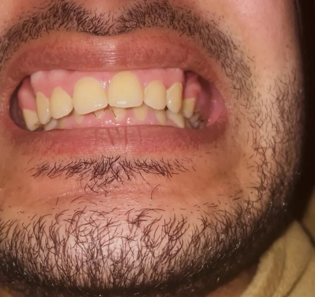 تقويم الاسنان