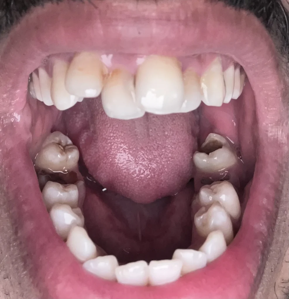 سنان معوجين، سوسة و صفورية