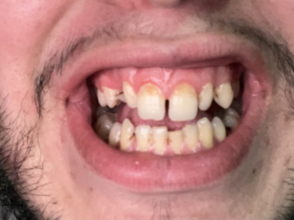 Ayoub Tissir – Agadir – Orthodontie
