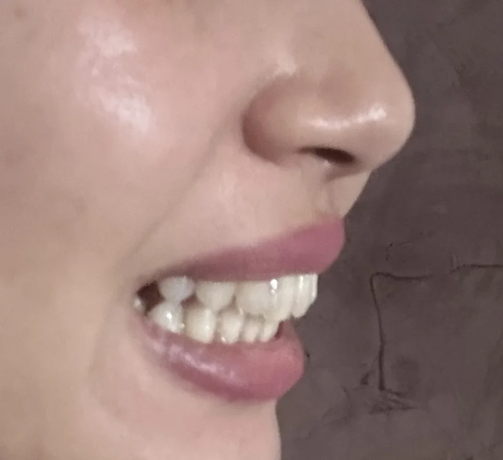 Besoin de faire des goutières