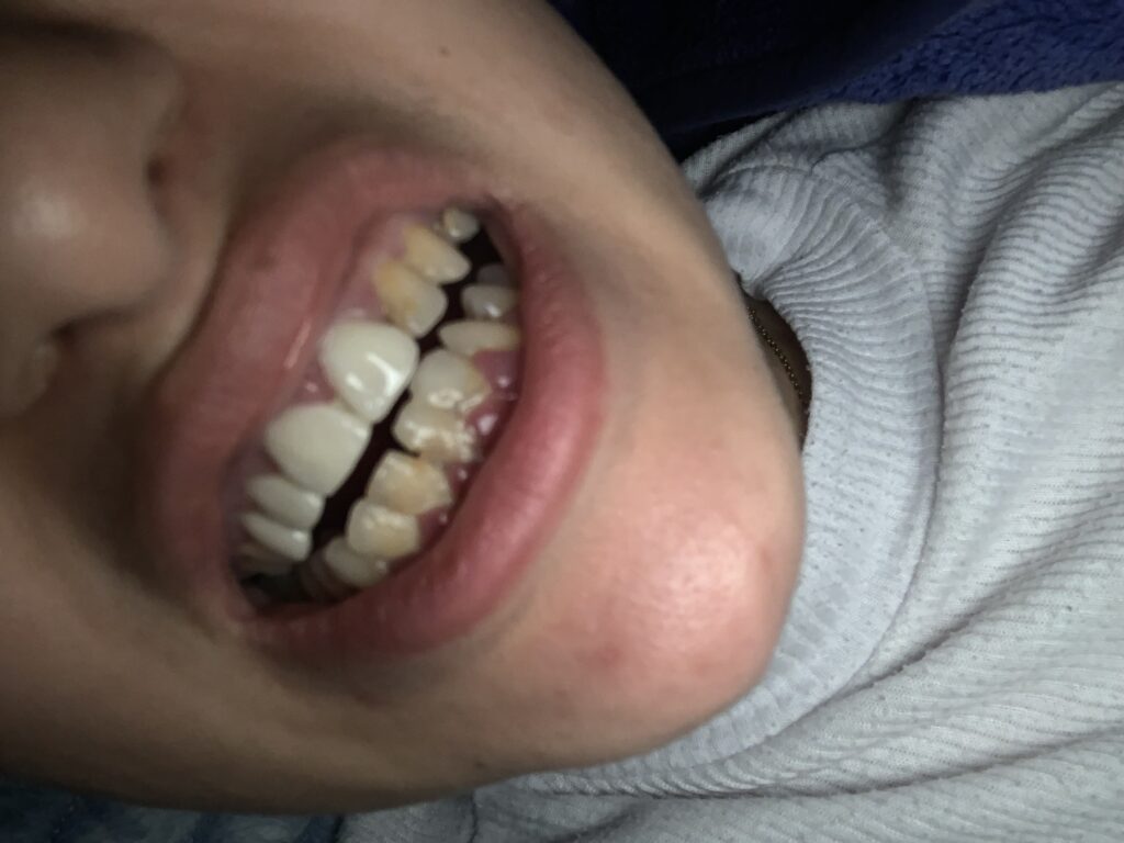Oumaima Tribak – Tangier – Hollywood Smile