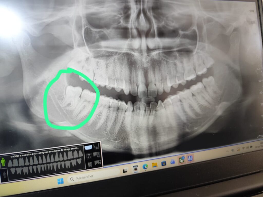 EL BARNOUSSI CHAIMAE – Tangier – Extraction