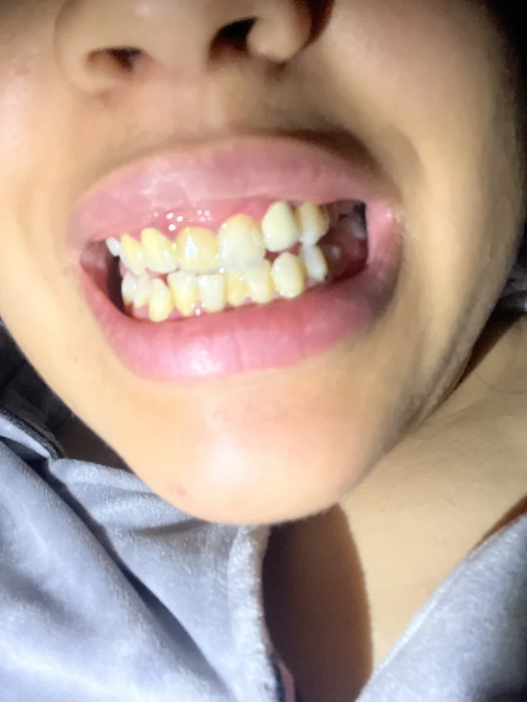 ألم في دروس خلفية