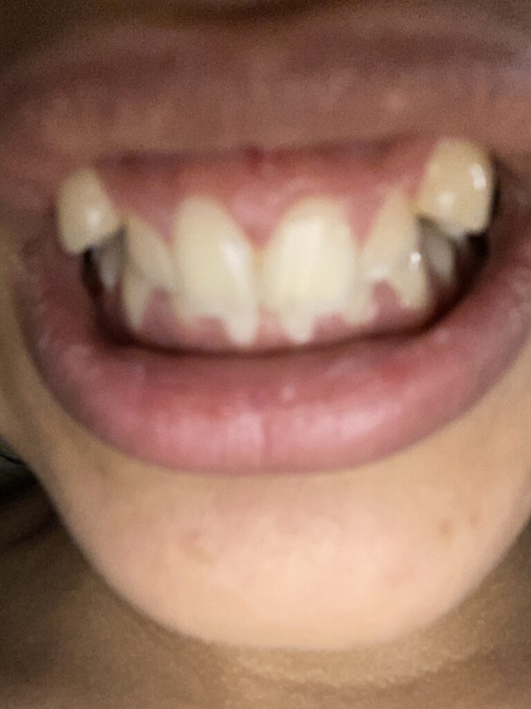 Khadija aman – Casablanca – Orthodontie