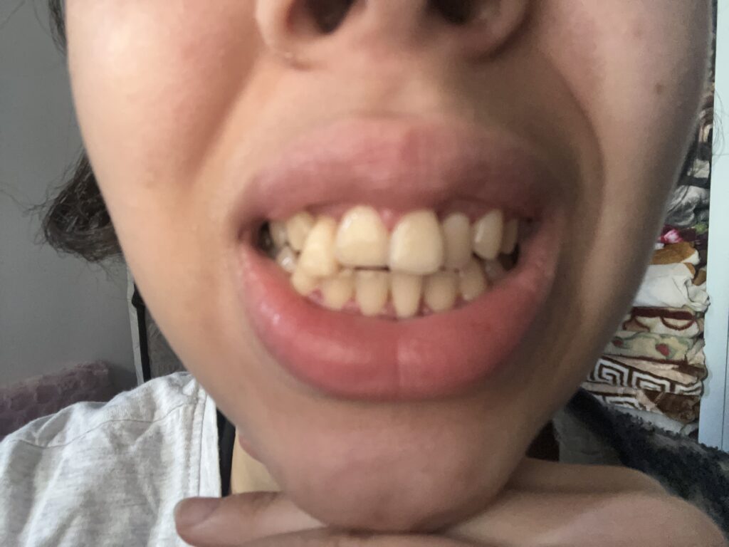 Houdaina Zaarane – Casablanca – Parodontologie