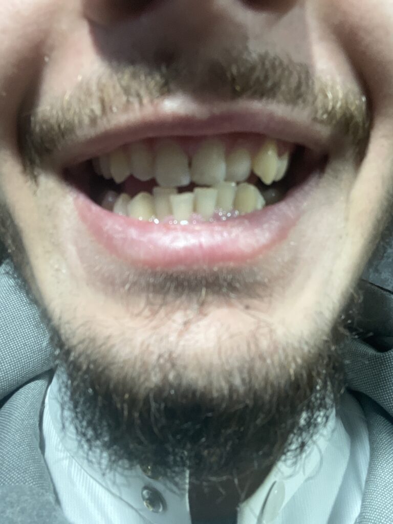 Hag – Fes – Orthodontie