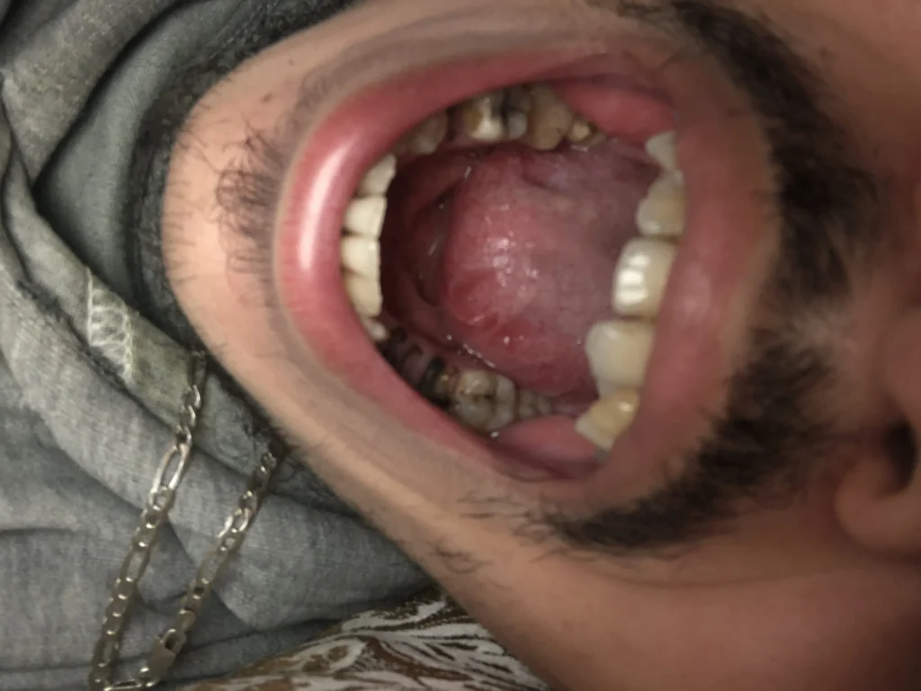 نعرف تمن نقاذ سناني كاملين