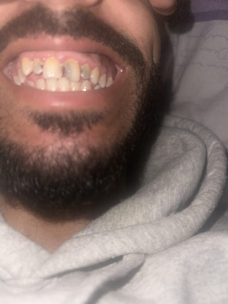 Ayman – Casablanca – Couronne
