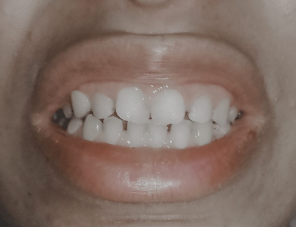 Jihane Kharbachi – Temara – Orthodontie