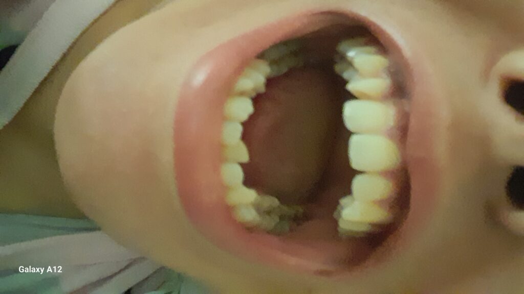 Imane – Casablanca – Hollywood Smile