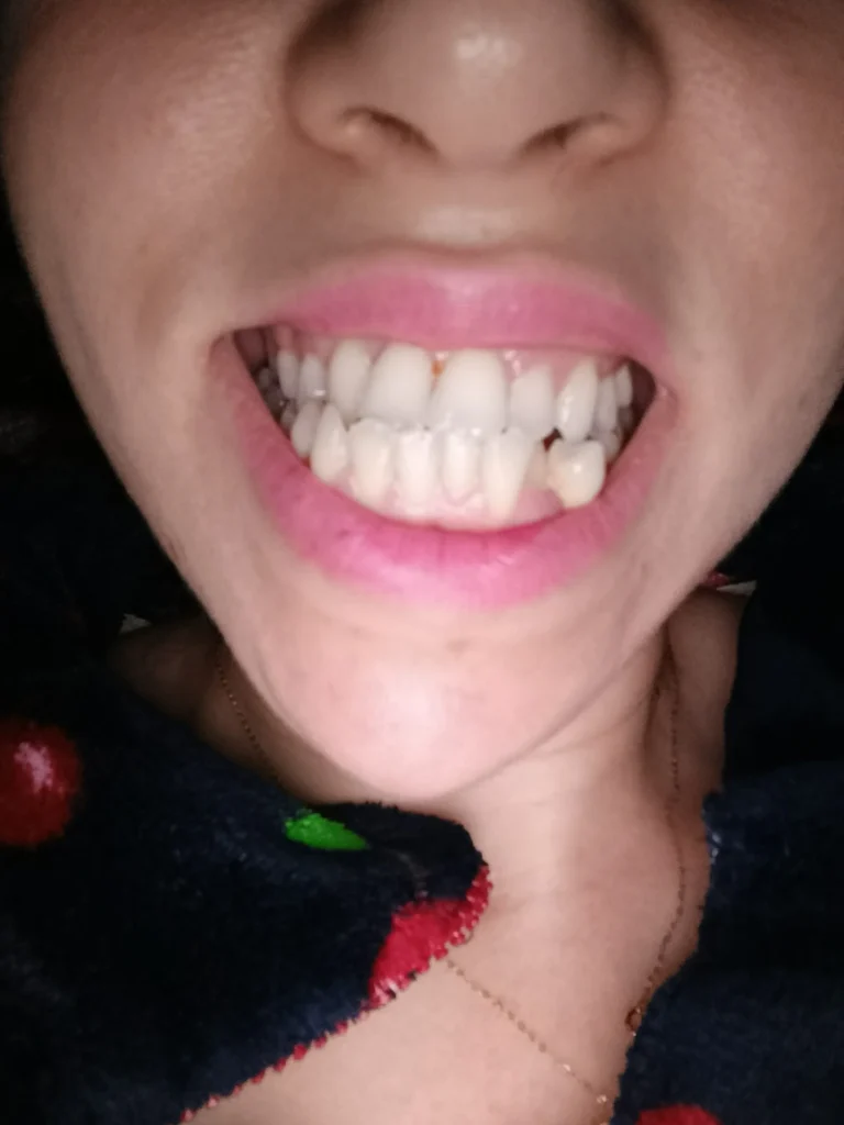 El ouazzani hafsa – Casablanca – Orthodontie