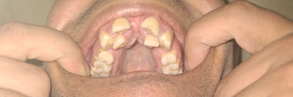 Soufiane mettouche – Casablanca – Urgence